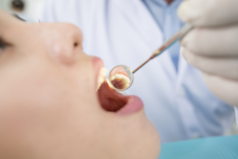 Oral cavity