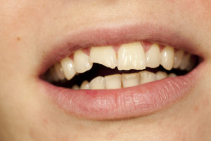 iStock 30034758 MEDIUM 1 300x200