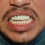 Close-up of man's face showing smile with facial hair and teeth