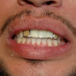 Close-up of a person's smile showing teeth and lips against skin.