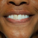 Close-up of person smiling, showing teeth and warm expression against neutral background.