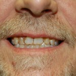 Close-up of man's face showing smile with beard and mustache
