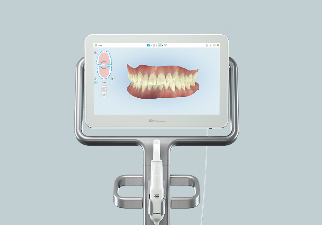 Digital dental scanner displaying 3D model of teeth and gums on screen